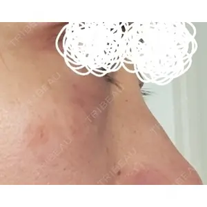 新宿Ladies&Gentlemen美容クリニック口コミ