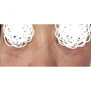 新宿Ladies&Gentlemen美容クリニック口コミ