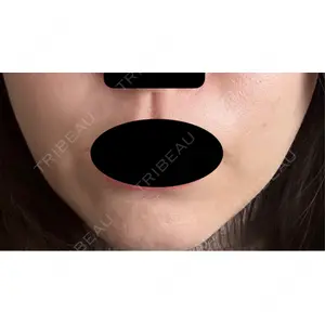 APスキンクリニック銀座口コミ