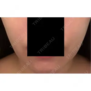 APスキンクリニック銀座口コミ