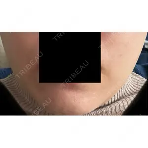 APスキンクリニック銀座口コミ