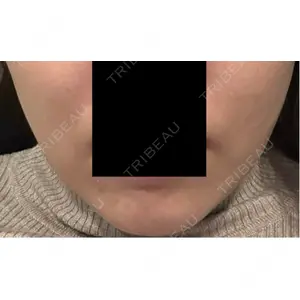 APスキンクリニック銀座口コミ