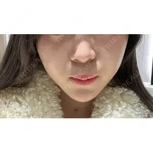 ルラ美容クリニック ルラ美容クリニック 大阪本院口コミ