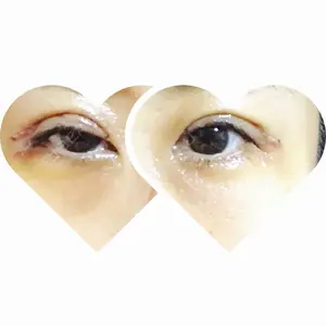 ブリスクリニック形成外科・美容外科・美容皮膚科 福岡口コミ