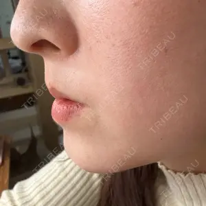 BITO BEAUTY CLINIC BITO BEAUTY CLINIC口コミ
