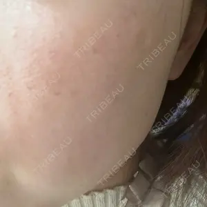 BITO BEAUTY CLINIC BITO BEAUTY CLINIC口コミ
