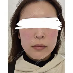 ルラ美容クリニック ルラ美容クリニック 郡山院口コミ