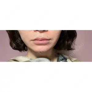 ルラ美容クリニック ルラ美容クリニック 郡山院口コミ