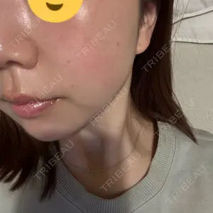 AZ BEAUTY CLINIC口コミ