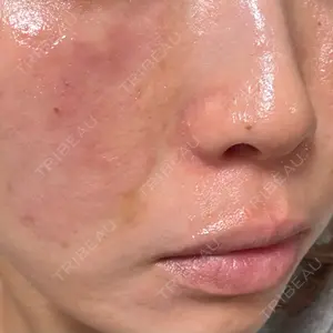 NARU Beauty Clinic NARU Beauty Clinic 【ナルクリ】 水戸院口コミ