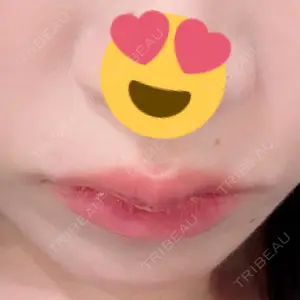 ビラビューティークリニック 博多美容外科/美容皮膚科 ビラビューティークリニック口コミ