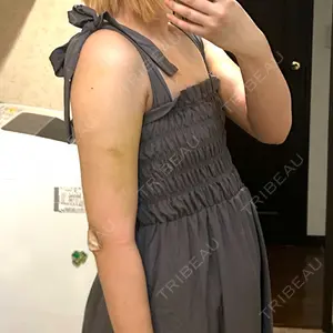 湘南美容クリニック 湘南美容クリニック 渋谷院口コミ