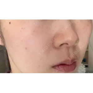トラスト美容クリニック トラスト美容クリニック 銀座院口コミ