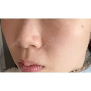 トラスト美容クリニック トラスト美容クリニック 銀座院口コミ