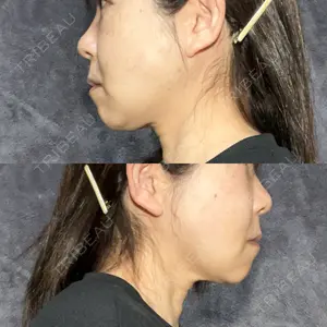 アリエル美容クリニック アリエル美容クリニック 水戸院口コミ