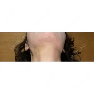 ルラ美容クリニック ルラ美容クリニック 郡山院口コミ