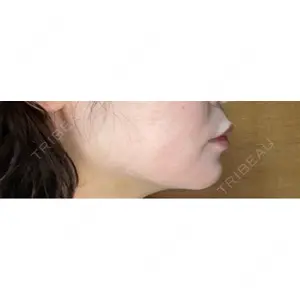 ルラ美容クリニック ルラ美容クリニック 郡山院口コミ