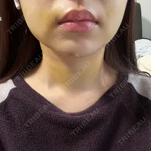 アリエル美容クリニック アリエル美容クリニック 大宮院口コミ