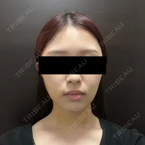 アリエル美容クリニック アリエル美容クリニック 大宮院口コミ