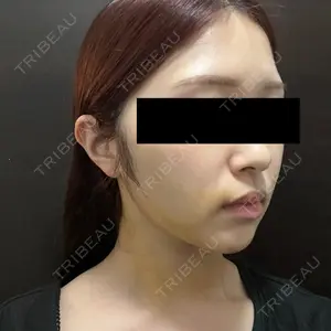 アリエル美容クリニック アリエル美容クリニック 大宮院口コミ