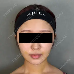 アリエル美容クリニック アリエル美容クリニック 大宮院口コミ