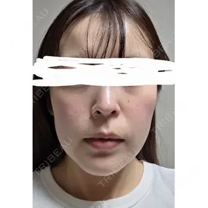 ルラ美容クリニック ルラ美容クリニック 郡山院口コミ