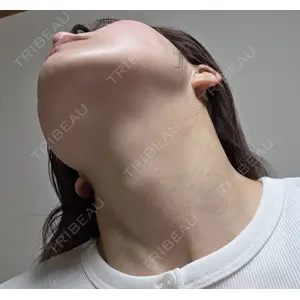 ルラ美容クリニック ルラ美容クリニック 郡山院口コミ