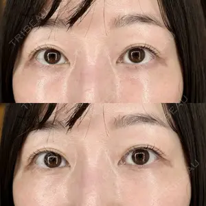 セオリークリニック口コミ