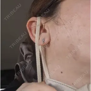 フォンタナクリニック天神口コミ