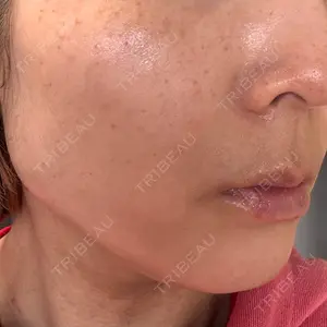 アクティブエイジクリニック アクティブエイジクリニック口コミ