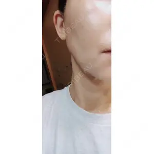 ルラ美容クリニック ルラ美容クリニック 郡山院口コミ