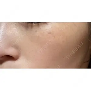 ルラ美容クリニック ルラ美容クリニック 仙台院 / ルラスキンクリニック 仙台院口コミ