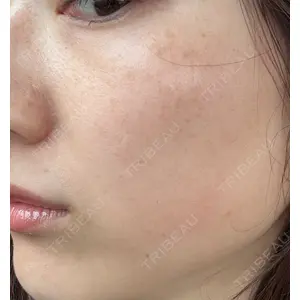 L‘amour clinic Tokyo【ラムールクリニック東京】口コミ