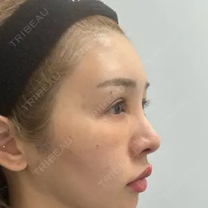 plume clinic plume clinic口コミ