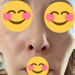 やさしい美容皮膚科・皮フ科 やさしい美容皮膚科・皮フ科　秋葉原院口コミ