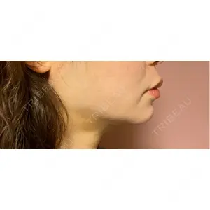 ルラ美容クリニック ルラ美容クリニック 郡山院口コミ