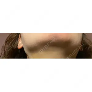 ルラ美容クリニック ルラ美容クリニック 郡山院口コミ