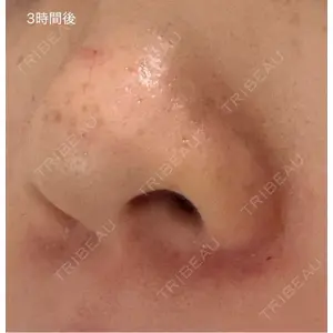 日本美容・医療クリニック 日本美容・医療クリニック 六本木院口コミ