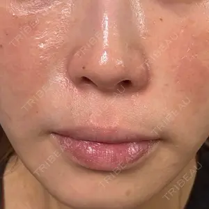 NARU Beauty Clinic NARU Beauty Clinic 【ナルクリ】 水戸院口コミ