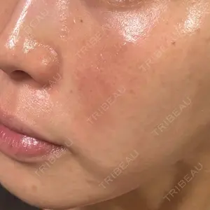 NARU Beauty Clinic NARU Beauty Clinic 【ナルクリ】 水戸院口コミ