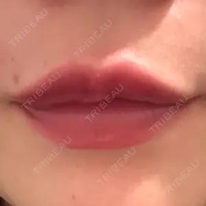 L‘amour clinic Tokyo【ラムールクリニック東京】口コミ