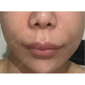 ルラ美容クリニック ルラ美容クリニック 岡山院口コミ