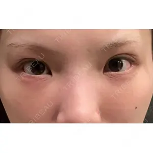 口コミ