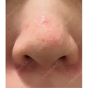 日本美容・医療クリニック 日本美容・医療クリニック 六本木院口コミ