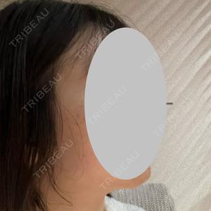 TCB東京中央美容外科 TCB東京中央美容外科 渋谷西口院口コミ