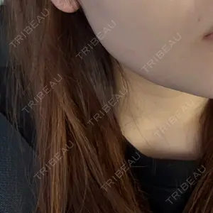 ビラビューティークリニック 博多美容外科/美容皮膚科 ビラビューティークリニック口コミ