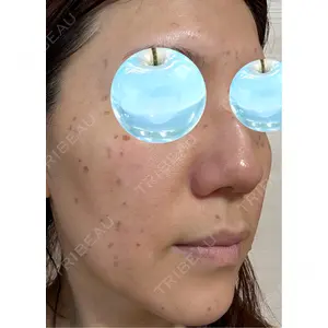 東京シルククリニック 東京シルククリニック 新宿院口コミ