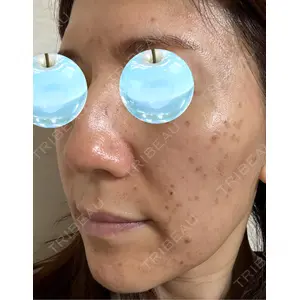 東京シルククリニック 東京シルククリニック 新宿院口コミ