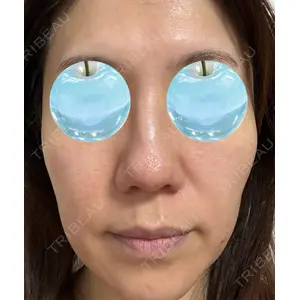 東京シルククリニック 東京シルククリニック 新宿院口コミ