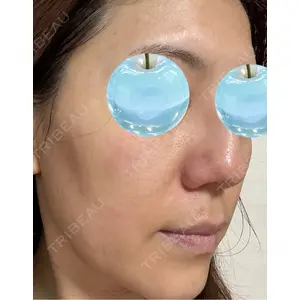 東京シルククリニック 東京シルククリニック 新宿院口コミ